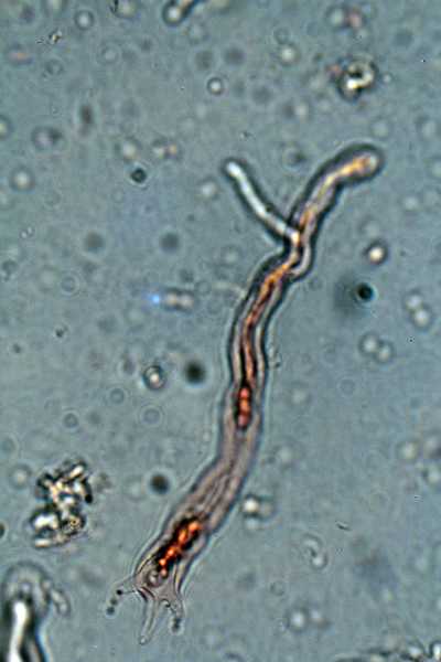 Corticium meridioroseum ?